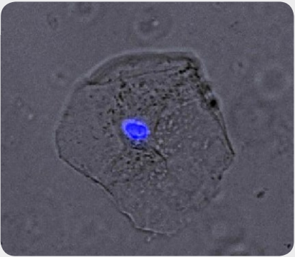 頬の細胞の核を染色し、ZOEの青蛍光チャネルで撮影